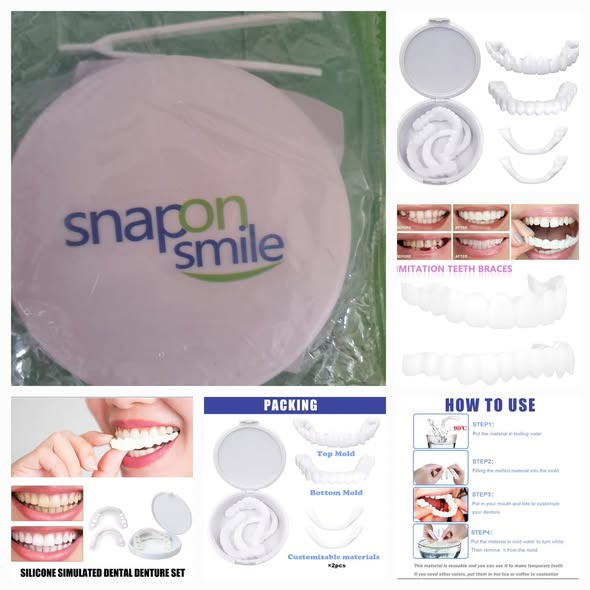 Snap on Smile-Pro : Confort et ajustement parfait